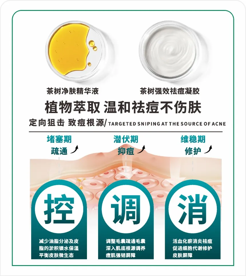 植物萃取温和祛痘